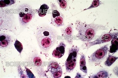 gram stain for chlamydia|chlamydia microscopy.